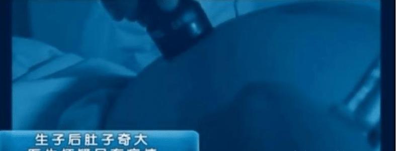 头胎刚满月又生二胎,头胎满月孕妇又要生产