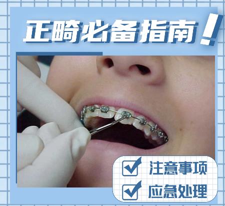 正畸治疗须知,正畸有哪些注意事项