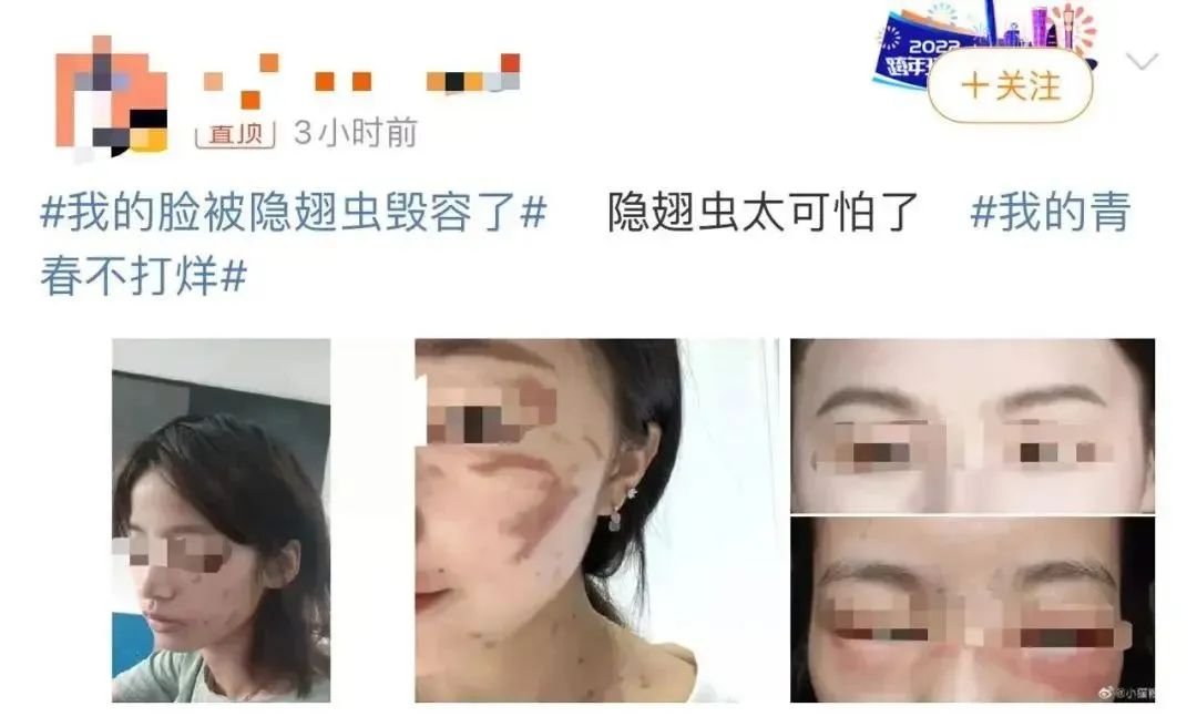 千万不要用手拍的几种虫子,碰到这些虫子千万不要去碰