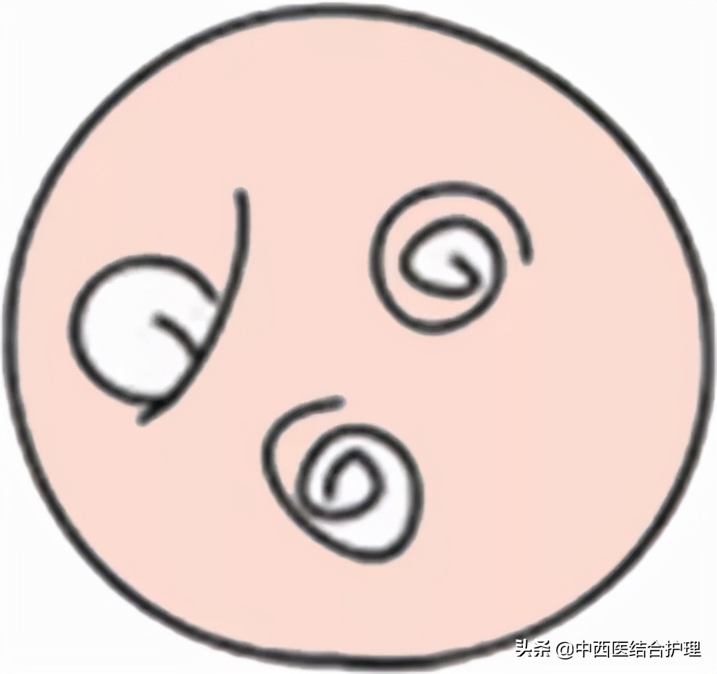 「脑梗病科普」一个周末8个脑梗，他们都有一共同特点！​神药安宫牛黄丸到底能不能救命？