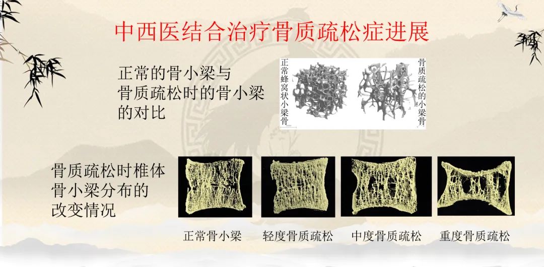 骨质疏松症的讲座总结,骨质疏松中医辨证施治