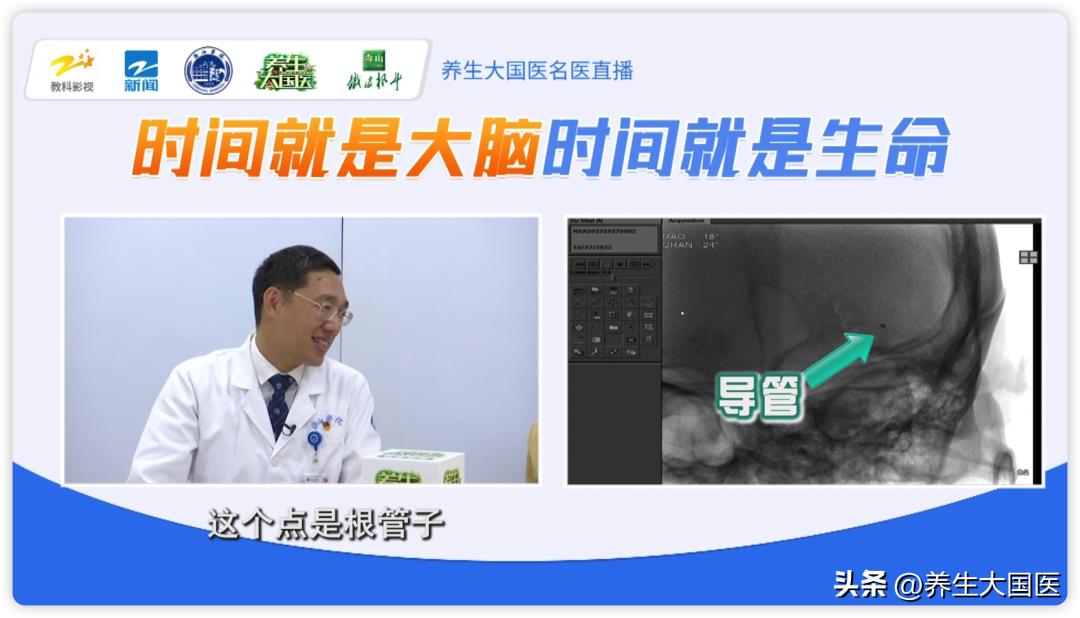 卒中危险因素有哪些,卒中全程管理