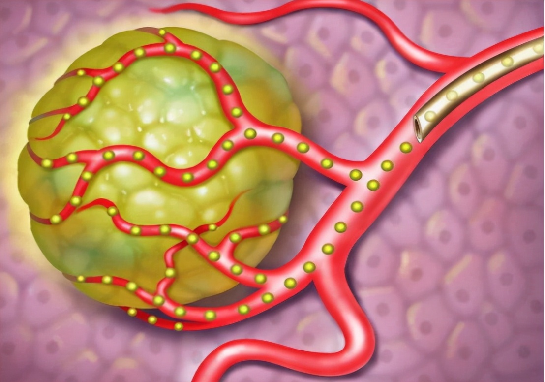 中国研发杀死癌细胞的新药了吗,23年抗癌药上市针对哪些癌