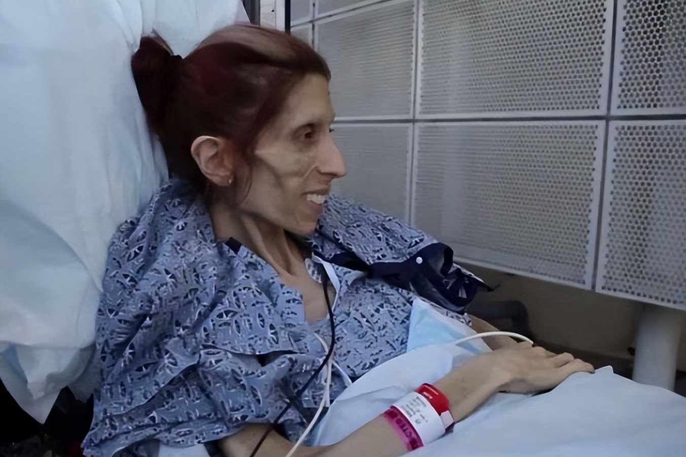 老人缺钙应服用哪些补钙药品,老年人缺钙吃什么补钙产品好