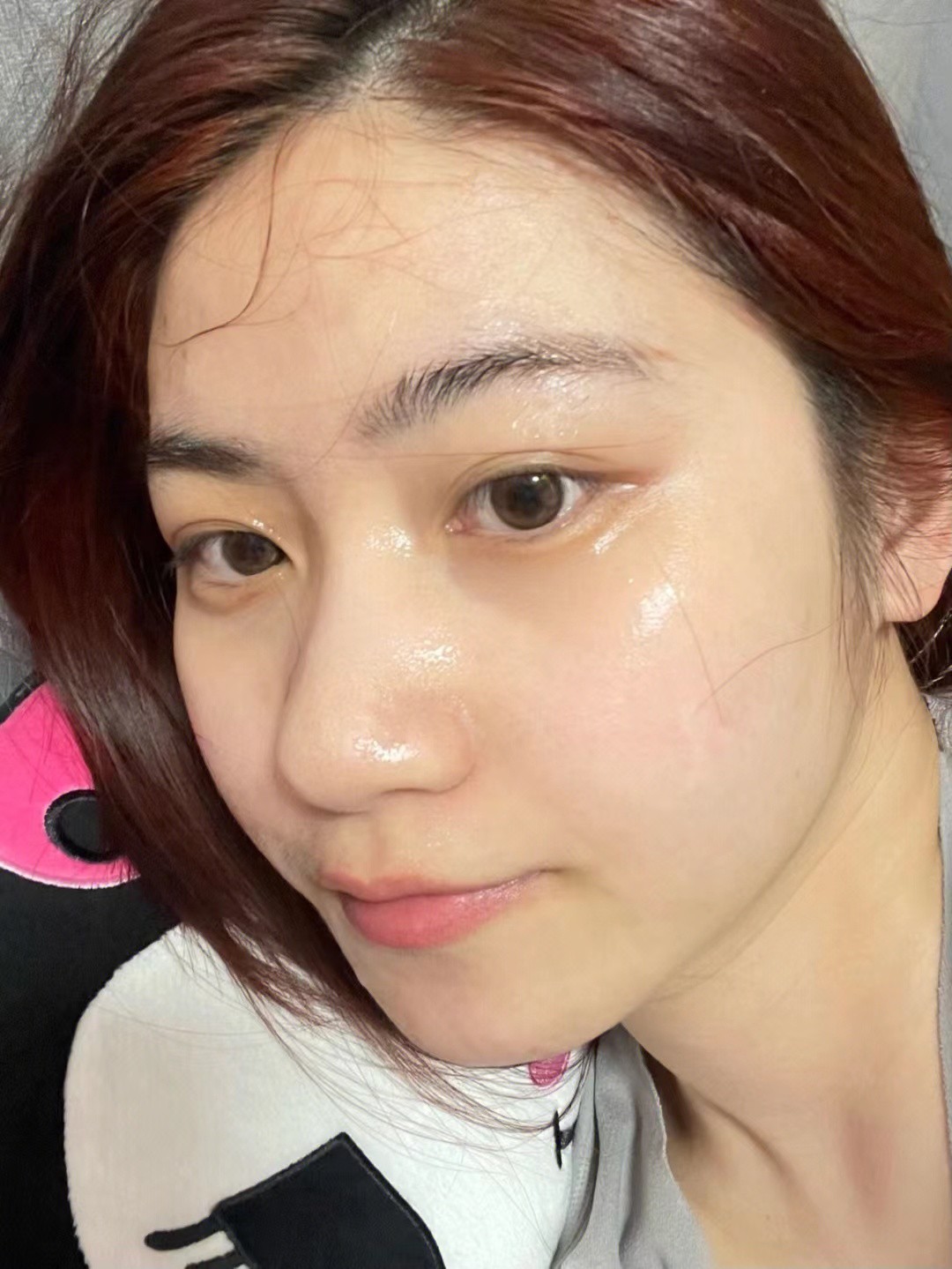 脸干到爆皮夏季怎么护肤,为什么你的脸越洗越油