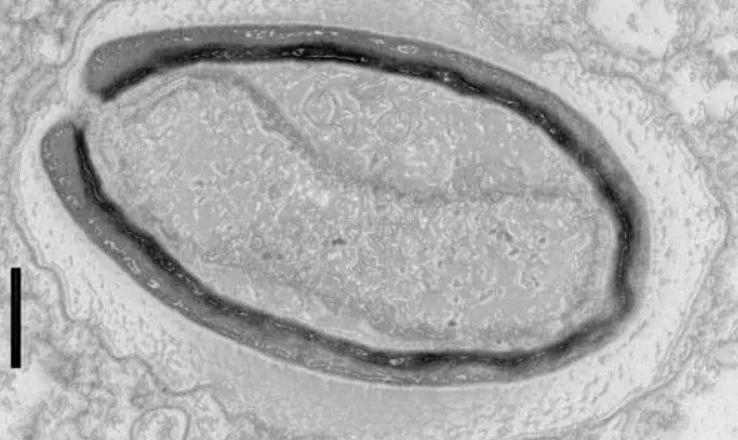 科学家复活潘多拉病毒 (人们为什么要复活潘多拉病毒)