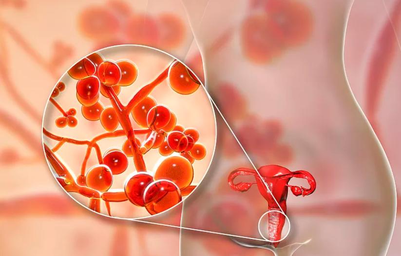 女人的“尴尬部位”老是瘙痒?医生:这4个原因,最好一个个弄清