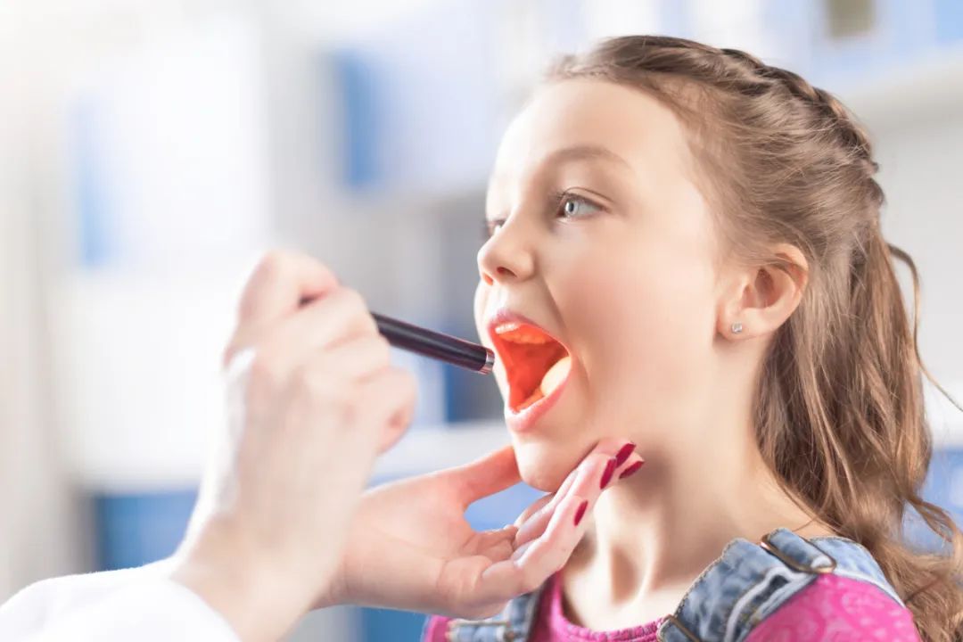 双黄连口服液可以治咽峡炎吗,疱疹性咽峡炎喝双黄连口服液行吗