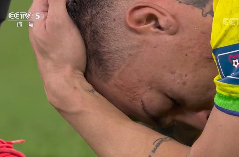 世界杯爆冷事件巴西,世界杯爆冷巴西