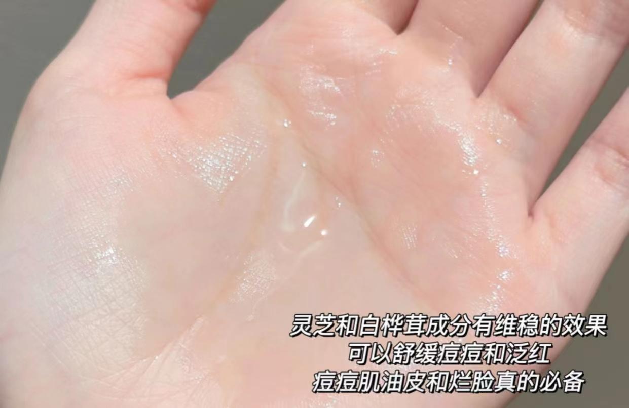 痘痘肌敏感肌良心推荐,痘痘肌敏感肌精华水推荐