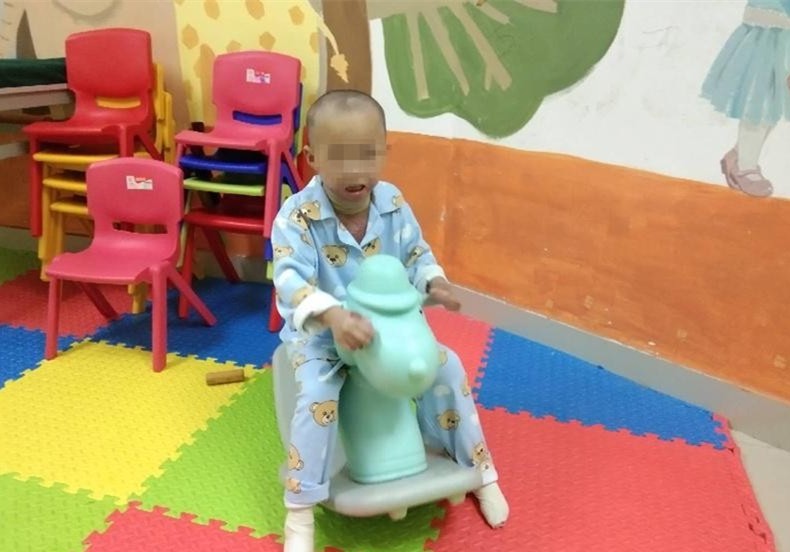 2岁女童被烧伤现场哭声让人揪心,6岁孩子被火烧伤后续