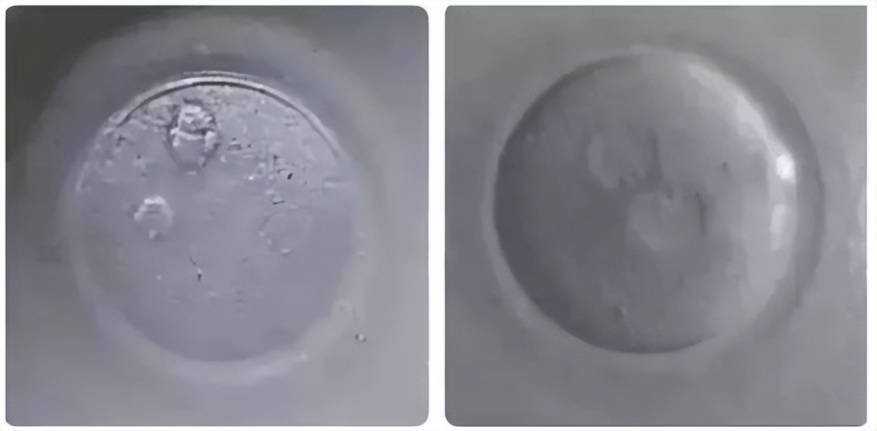 试管婴儿失败是流产吗,试管精子和卵子不能自然结合原因