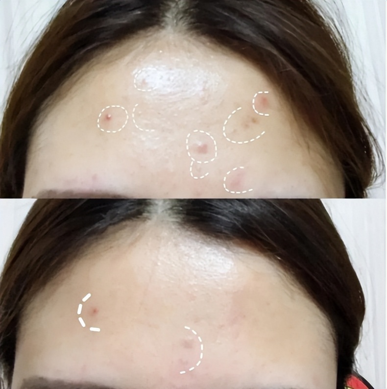 高夫洗面奶怎么选购,干性皮肤怎么选购洗面奶