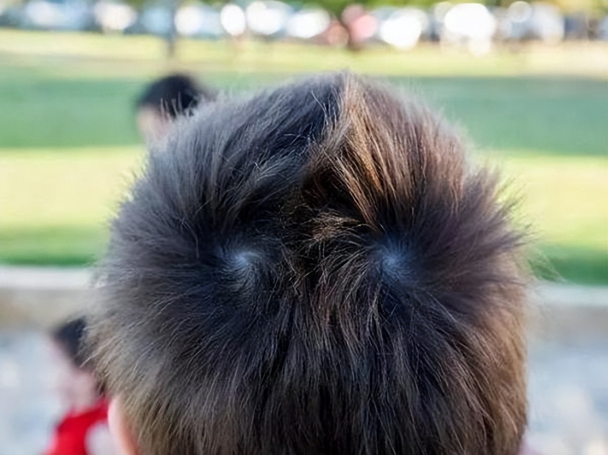 孩子头上的旋代表什么,儿童头上的旋有什么讲究