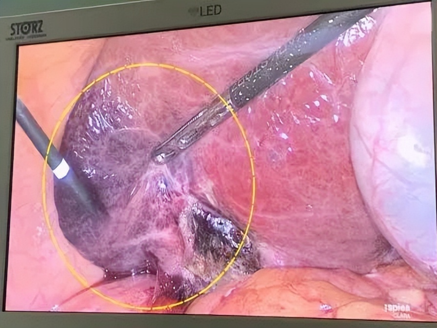 门急诊健康知识科普,门急诊相关知识