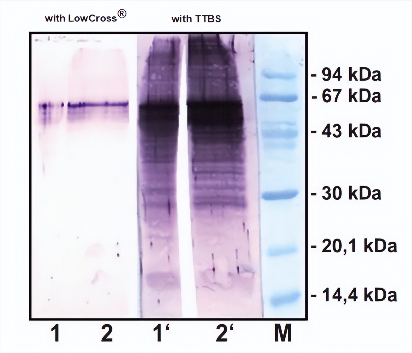 常见的免疫分析方法,免疫检验有哪些干扰
