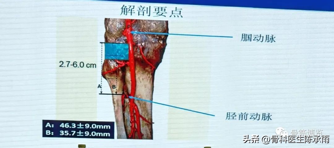 国家卫健委主办的骨创伤专项能力培训项目----下肢损伤学习班