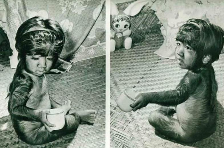 当年轰动一时的“毛孩”：42岁娶90后娇妻，生下一子未遗传长毛