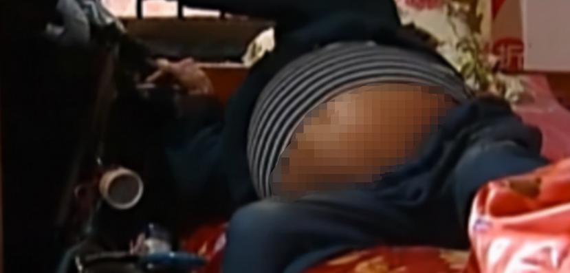 重庆一妇女肚子巨大,女子肚大如球竟是5颗肿瘤