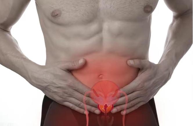 前列腺炎患者远离这4个错误行为,泌尿外科给男性的忠告