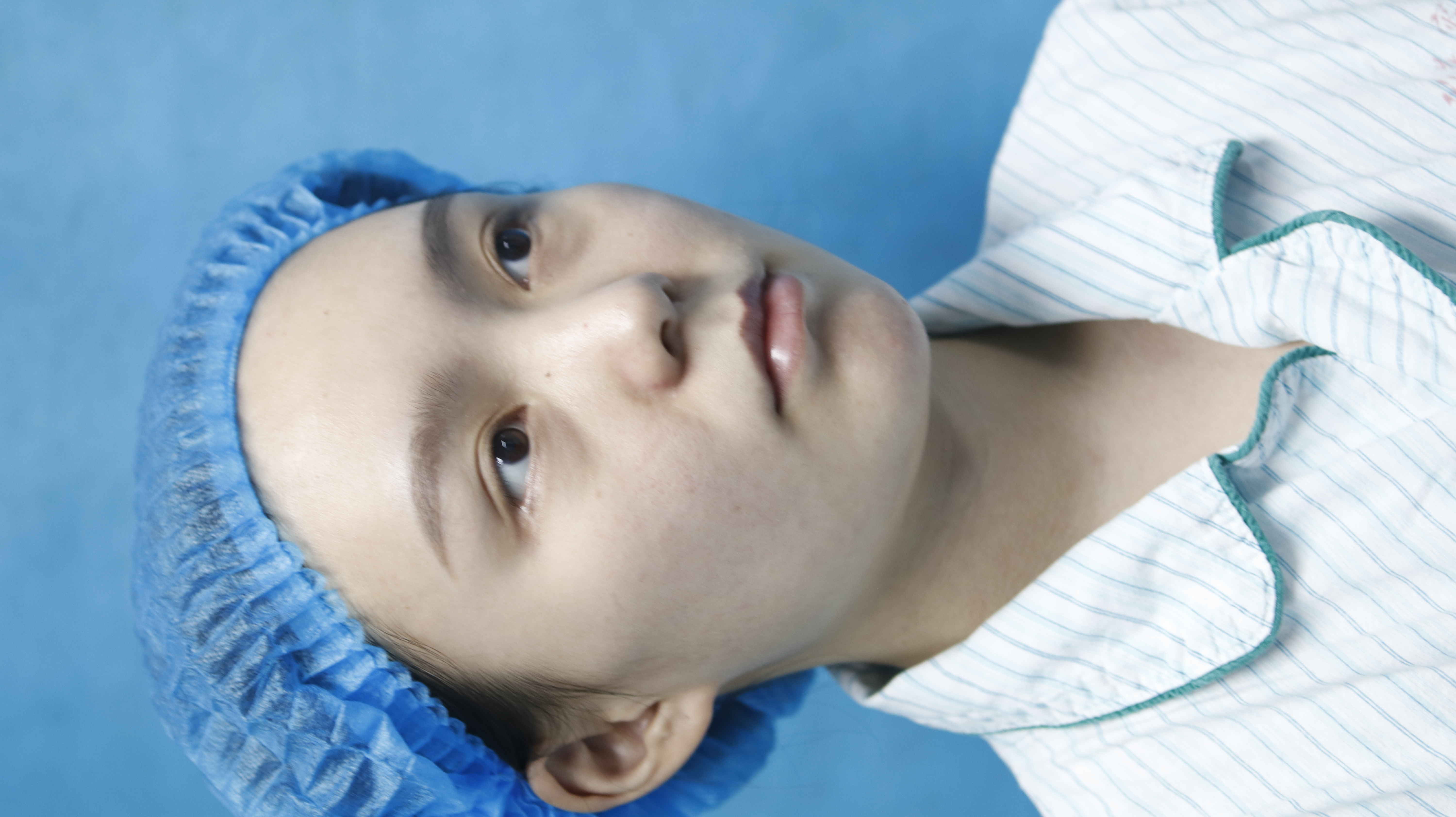 上海第九人民医院不开刀去除眼袋,顽固眼袋别担心不开刀也能变好看