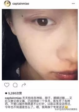 敏感肌油肌正确护肤方法,轻敏感肌怎么护肤