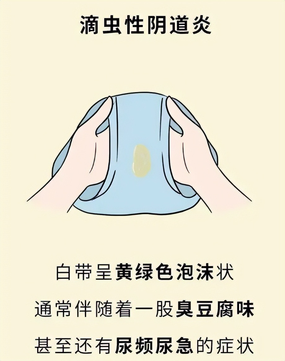 身上有怪味是大病的预兆,人如果生大病了身上会有异味