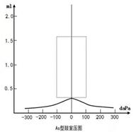 鼓室图片,鼓室图