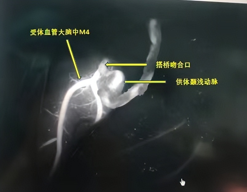 14宀佺敺瀛╃獊鐒剁儫闆剧梾,13宀佺敺瀛╃儫闆剧梾鎬庝箞寰楃殑