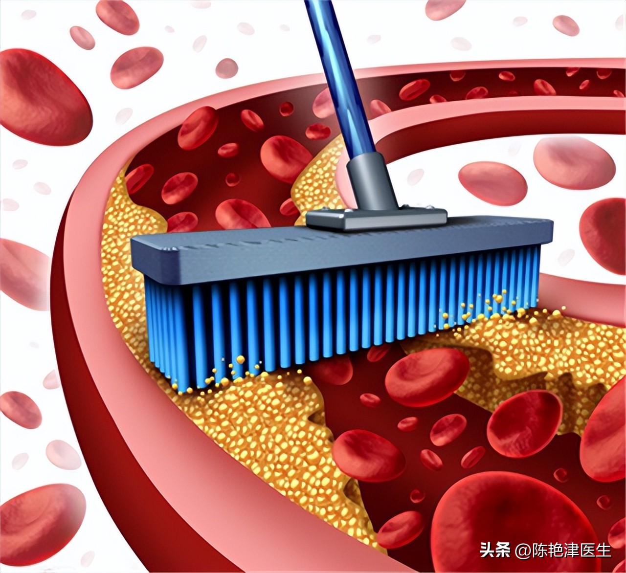 血脂高到什么程度要服用降脂药,血脂高多少需要吃降脂药