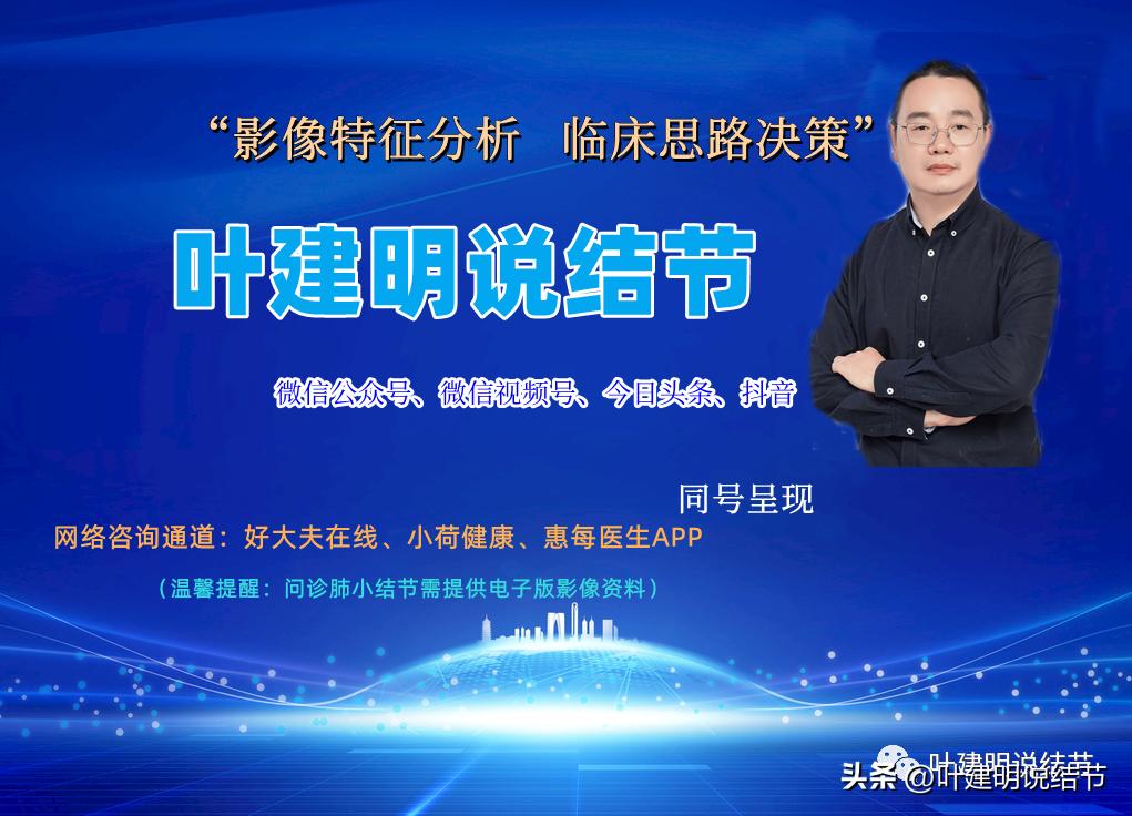 右下叶磨玻璃结节5*4,右下叶磨玻璃样结节多为炎性