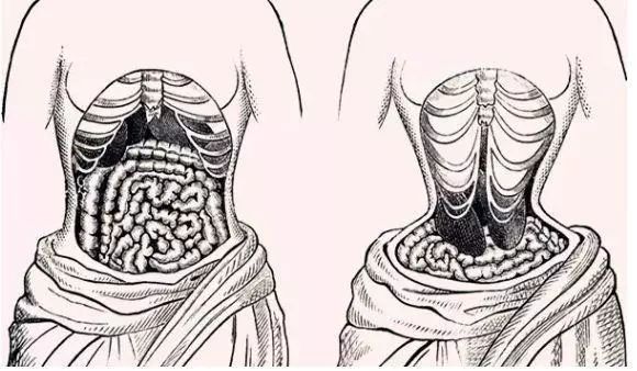 中世纪紧身胸衣,欧洲紧身胸衣样式