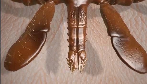 致命蜱虫,比蜱虫还可怕