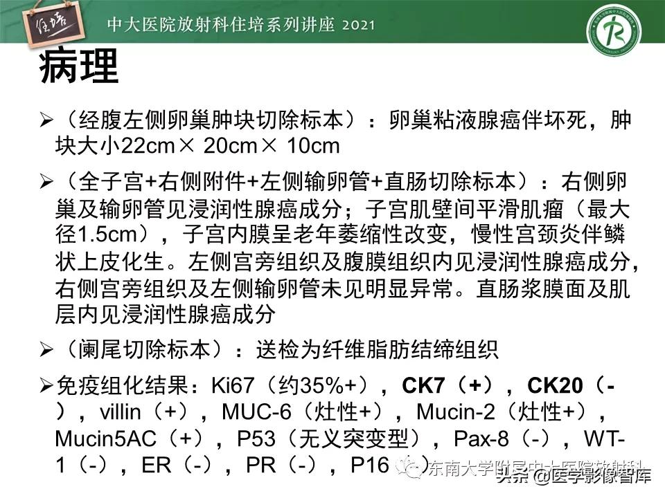 卵巢浆液性肿瘤的肉眼及镜下特征,卵巢原发性粘液性囊腺瘤