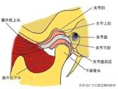 颞下颌关节紊乱会不会跑步咔咔响,颞下颌关节紊乱沙沙的响