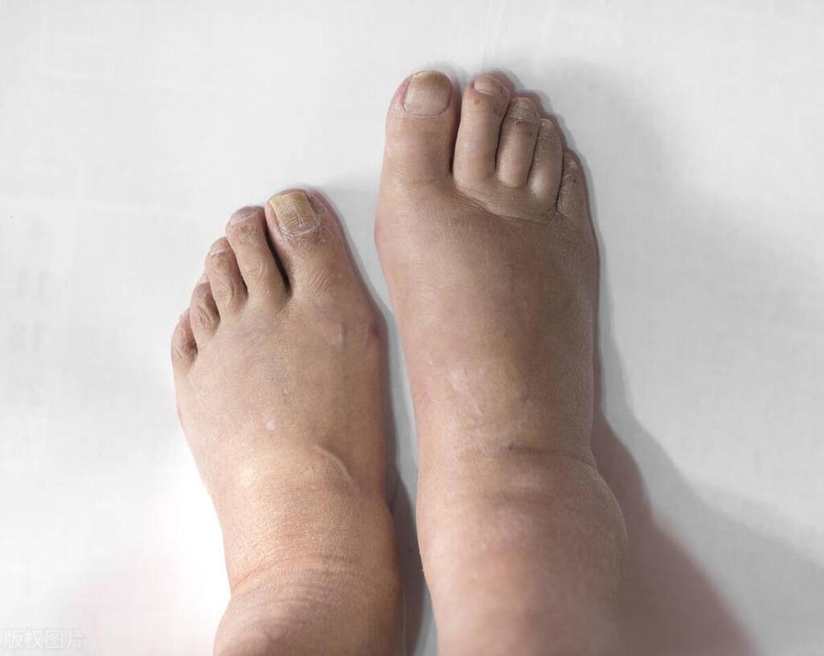 金匮肾气丸方子和功效,金匮肾气丸可以治疗哪些病症