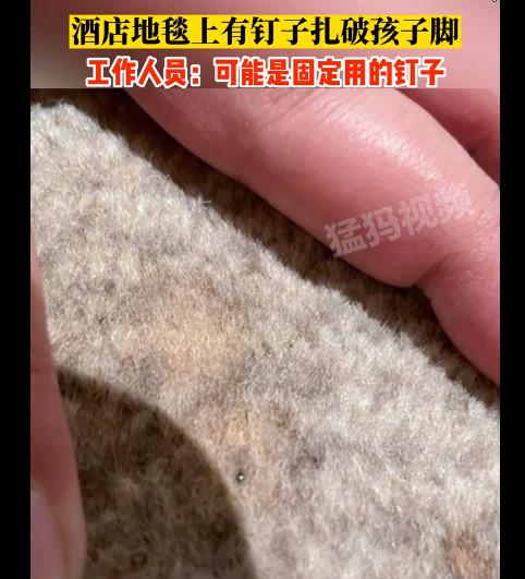 钉子扎脚丫,小男孩的脚被钉子扎穿了