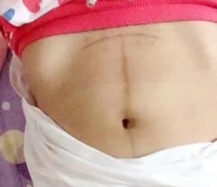 儿媳怀胎9个月去世,儿媳妇怀孕9个月去世