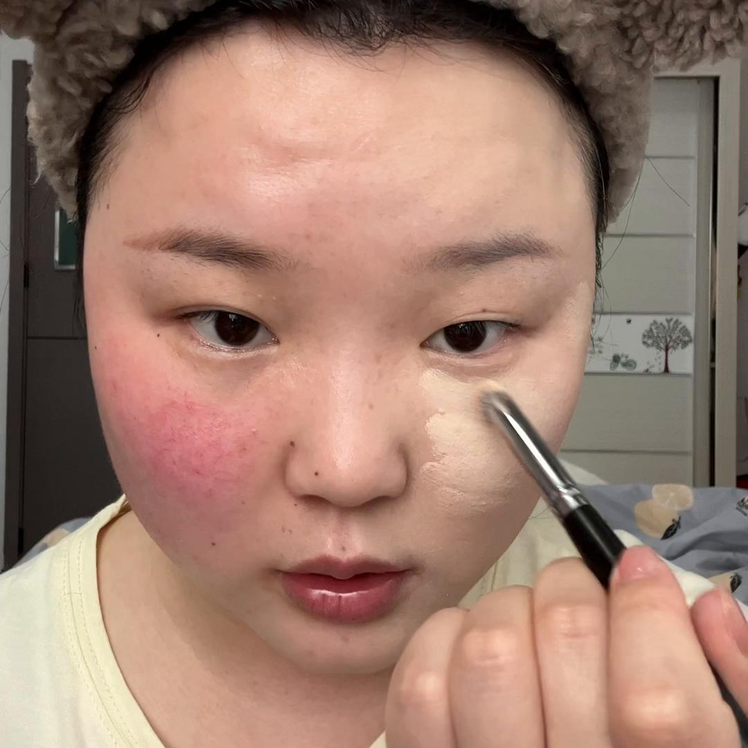 儿童妆嘴边红血丝怎么化,婴儿脸有红血丝能涂面霜吗