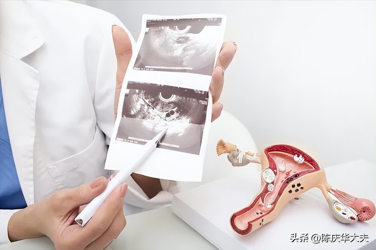 无痛人流术后感觉不痛正常吗,无痛人流大概多少钱