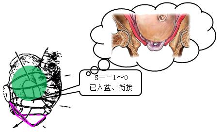 孕妈妈怎么判断胎位是正的,胎儿屁股在右侧是什么胎位