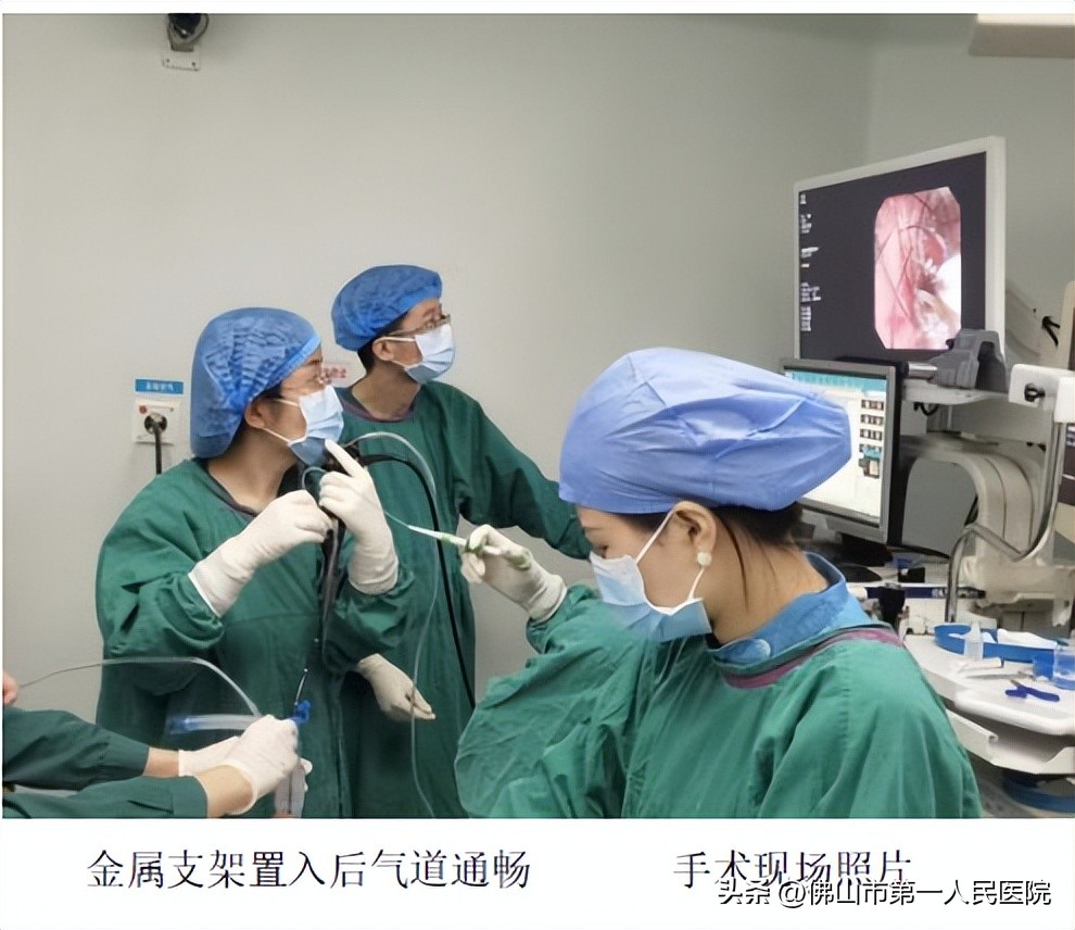 食道癌抢救病人视频,食道癌呼吸困难需要放支架吗