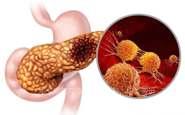 乔布斯治疗癌症花费多少钱,乔布斯抗癌8年花3亿