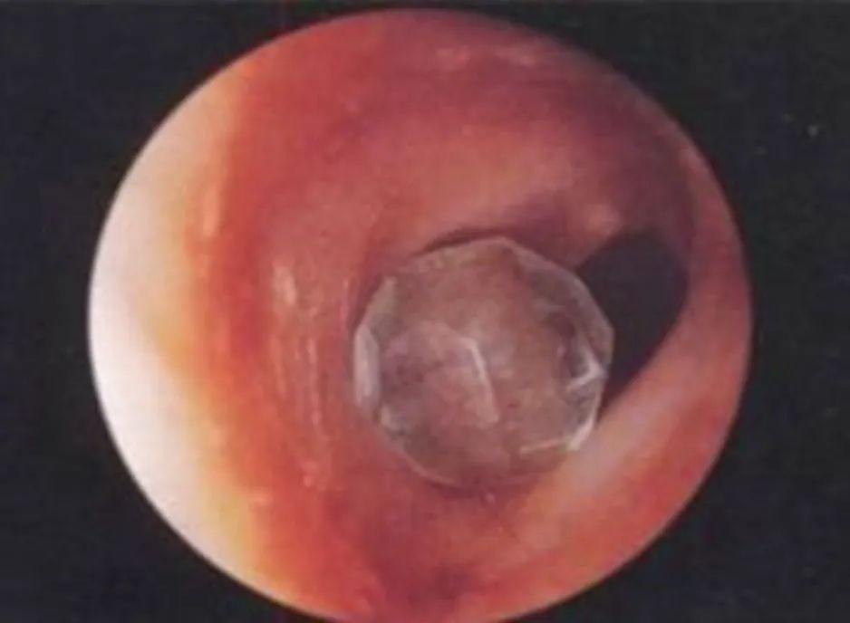 小东西解决大烦恼,小东西太多怎么解决