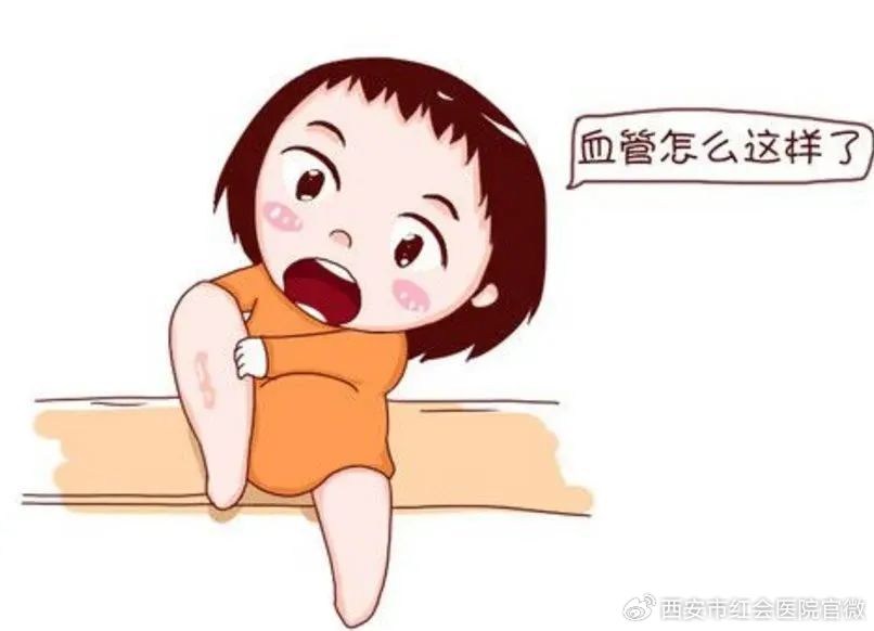 健康科普放血疗法,火针治疗静脉曲张的效果如何