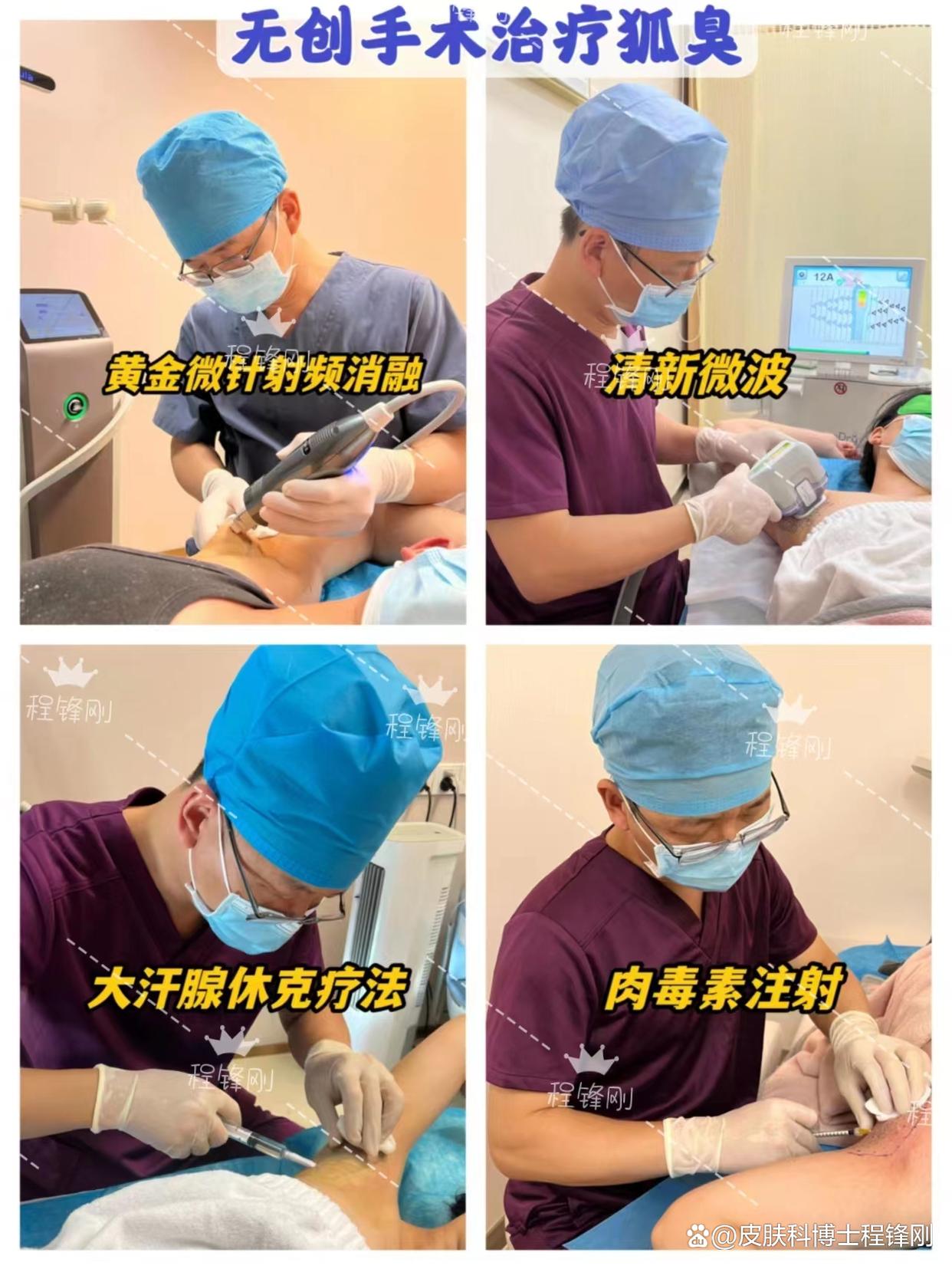 遗传性的狐臭可以彻底清除吗？