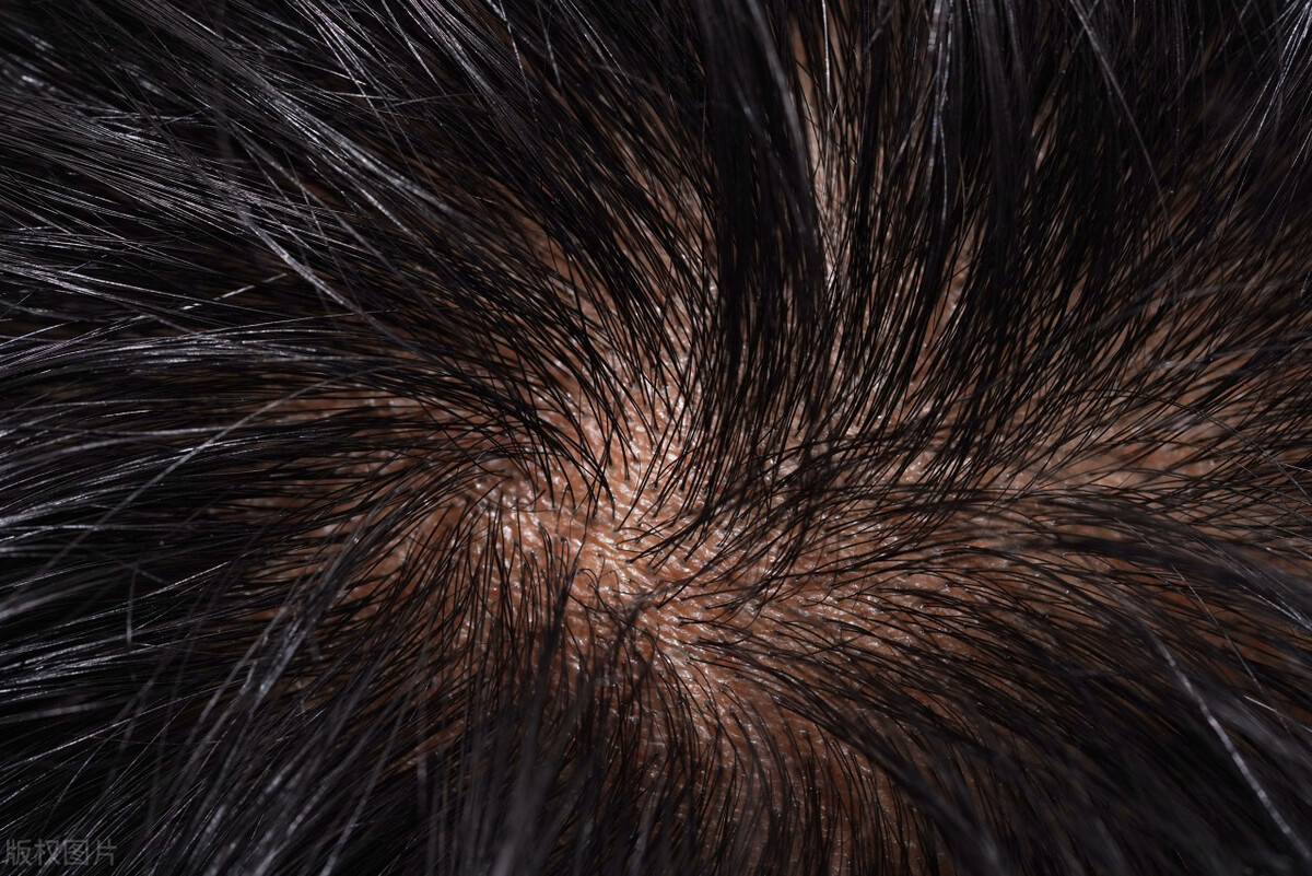 吃黑芝麻真的能补肾吗,一天吃多少黑芝麻可以补肾