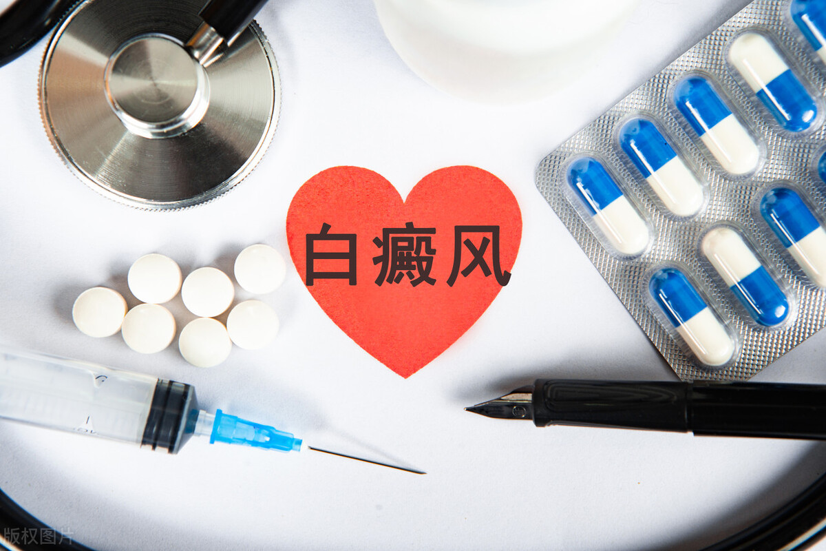 治疗白癜风需要哪些注意事项,儿童白癜风饮食上要注意什么呢