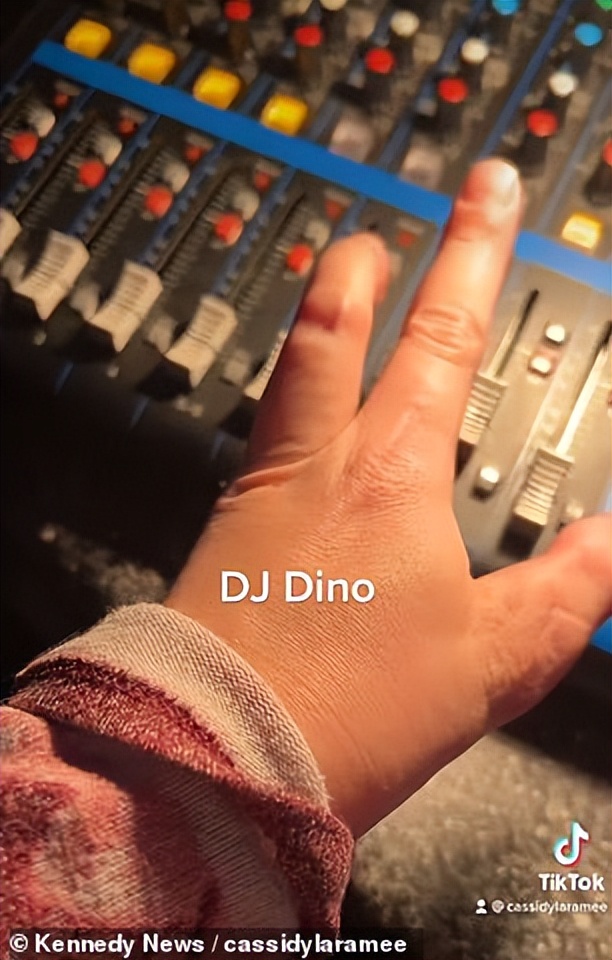 妹子天生只有3根手指，别人说她“霸王龙”，她用乐观狠狠反击！