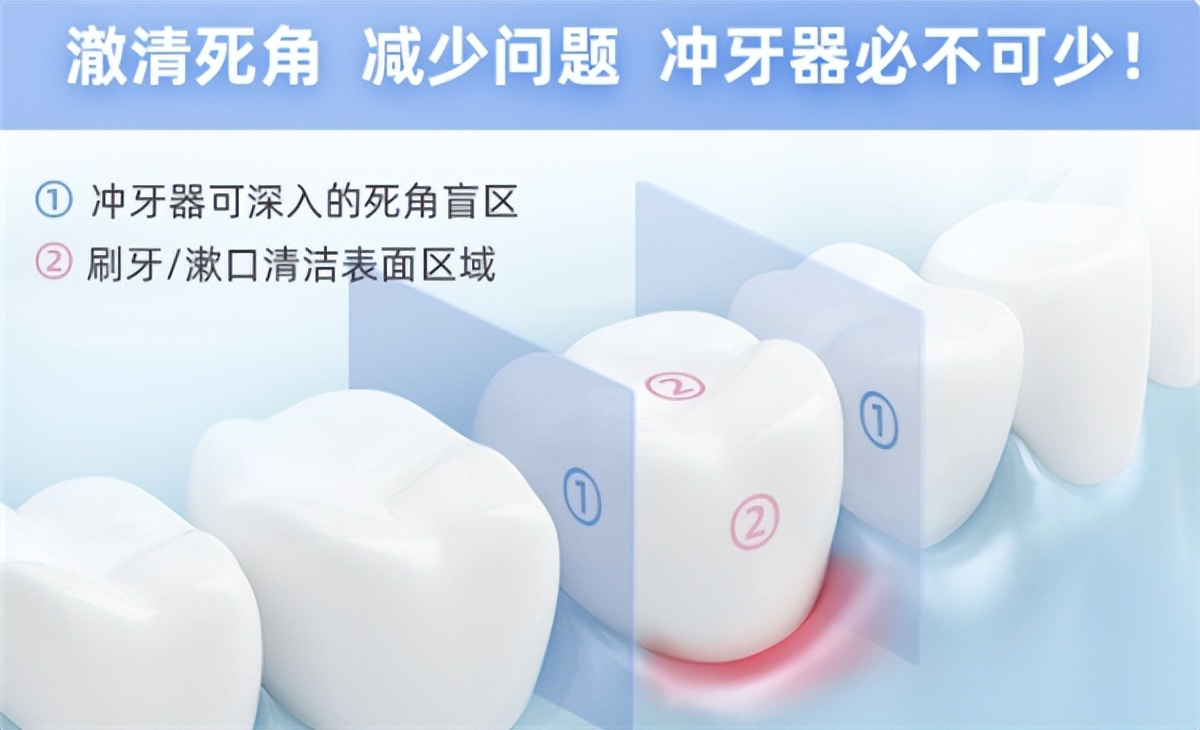 用冲牙器牙缝会变大吗,使用冲牙器会让牙缝变大吗